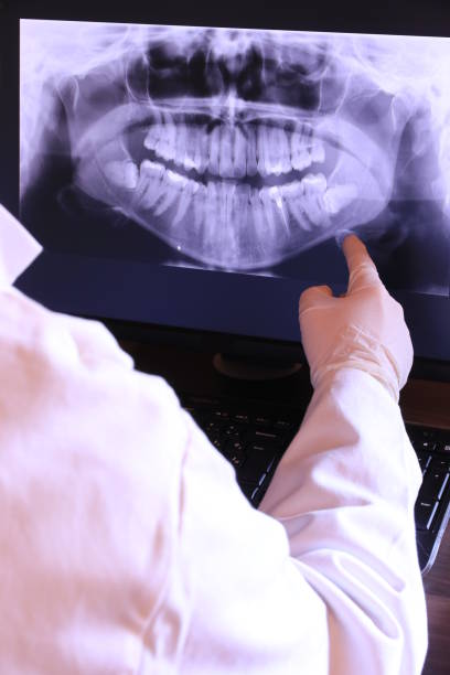 Best Emergency Wisdom Tooth Extraction in Kaneohe, HI